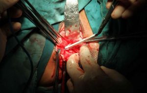 直播做手术暴露患者隐私部位，5万多人观看！医院通报：将内部教学视频错误使用公众平台进行网络直播学习，相关负责人被严重警告并停职